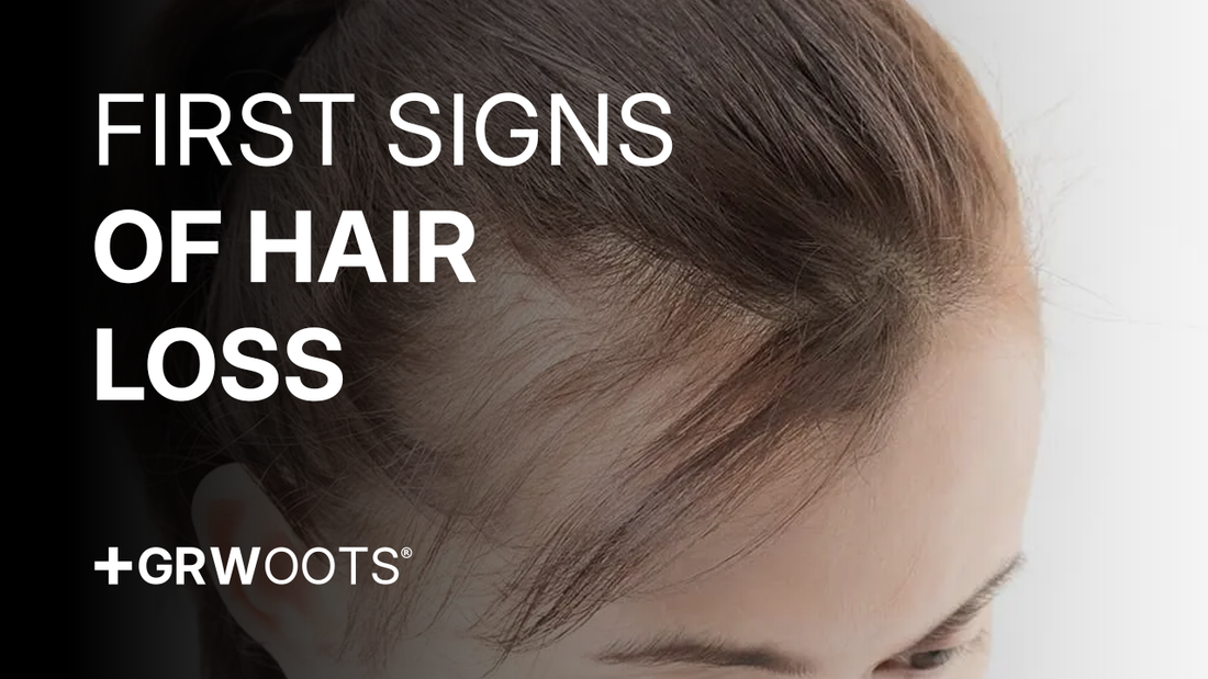 signs of hair loss