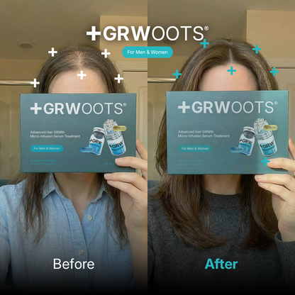 GRWOOTS® Micro-Infusion Haargroeibehandeling