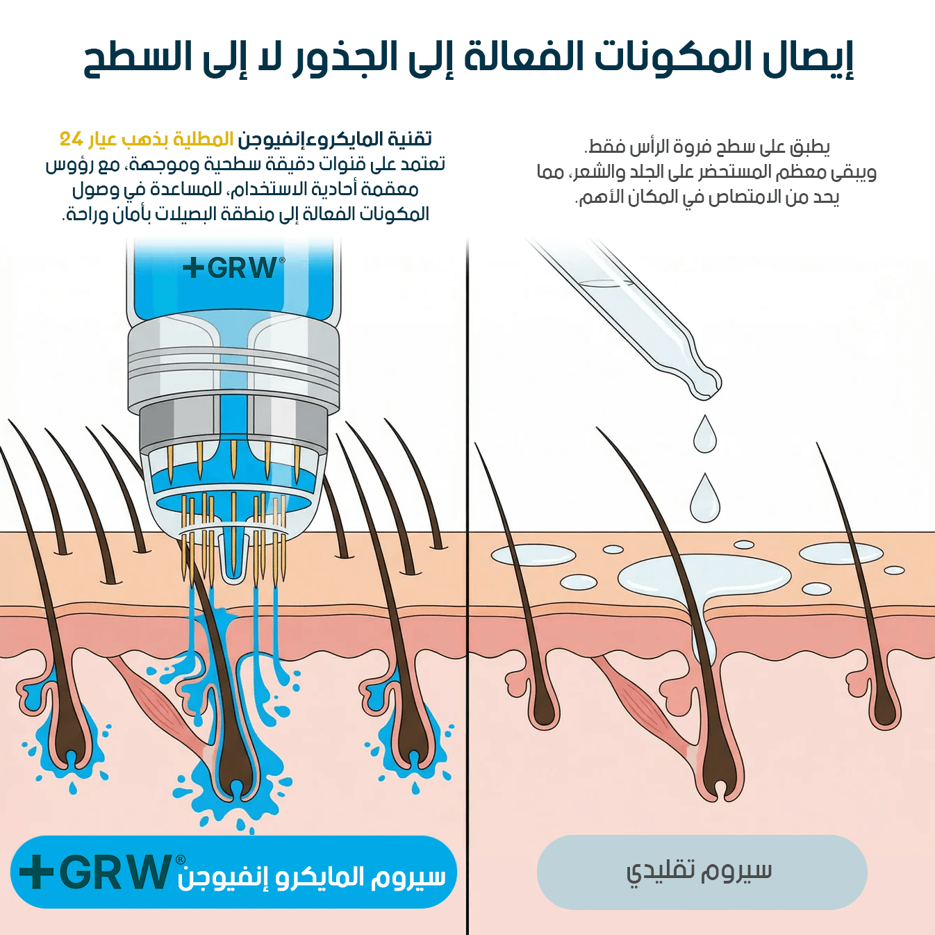 GRWOOTS® علاج بالحقن المجهري لتساقط الشعر ودعم نمو شعر أقوى وأكثر كثافة