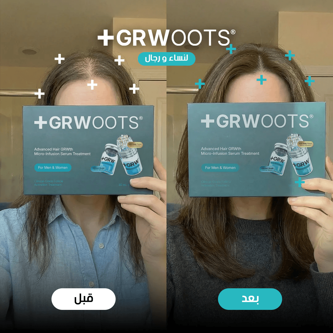 GRWOOTS® علاج بالحقن المجهري لتساقط الشعر ودعم نمو شعر أقوى وأكثر كثافة