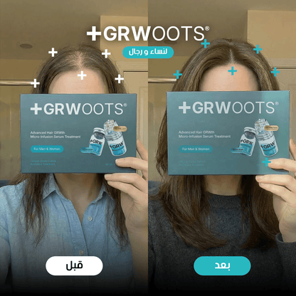 GRWOOTS® علاج بالحقن المجهري لتساقط الشعر ودعم نمو شعر أقوى وأكثر كثافة