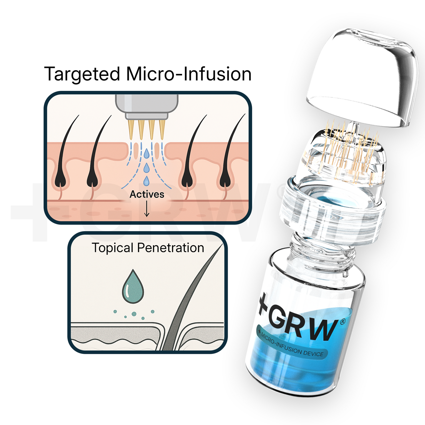 GRWOOTS® Micro-Infusion Growth Treatment