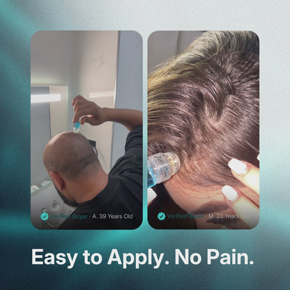 GRWOOTS® Micro-Infusion Growth Treatment